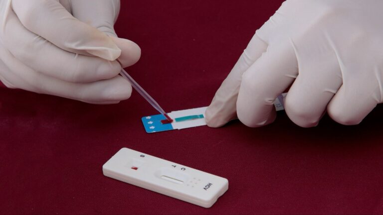 Con Jornada de Salud, ISSSTEP fortalece la atención integral de las mujeres