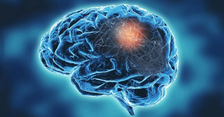 Puebla y el desafío del Alzheimer: Diagnóstico temprano y apoyo al cuidador como clave para un mejor abordaje integral de la enfermedad 