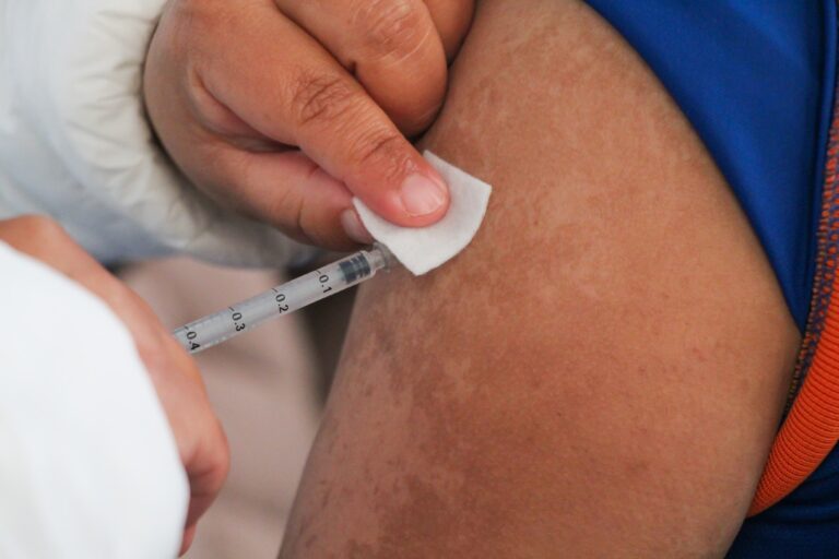 Sarampión, 30 años después