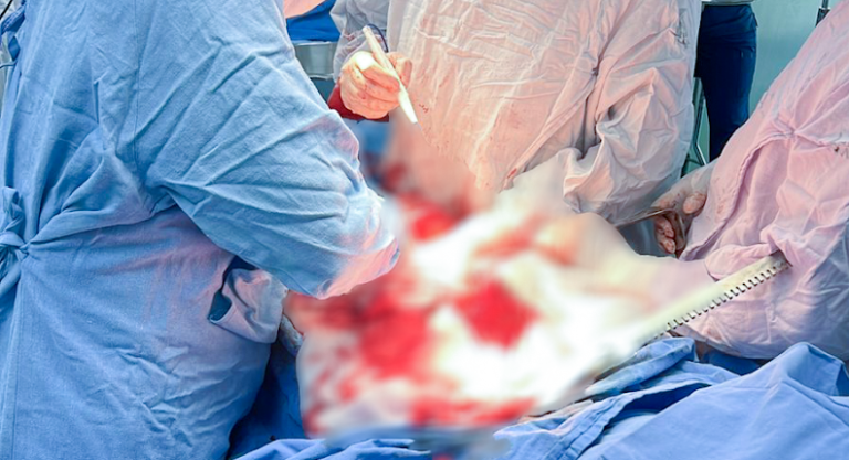 Realiza UMAE Hospital de Traumatología y Ortopedia del IMSS Puebla sexta procuración de órganos y tejidos