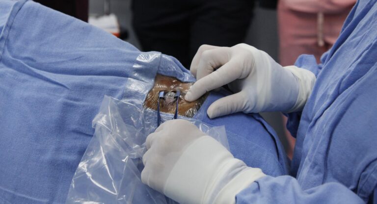 Realiza Hospital de Especialidades del IMSS Puebla trasplante de córnea